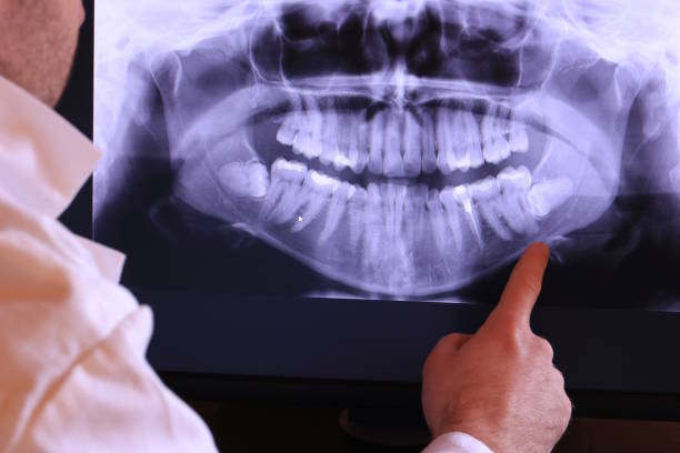Best Emergency Treatment for Toothache in Gordon, NE