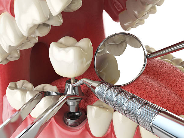Best Emergency Dental Surgery in Gordon, NE